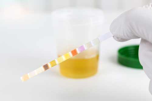 Best Practices for Employee Drug Testing in Denton